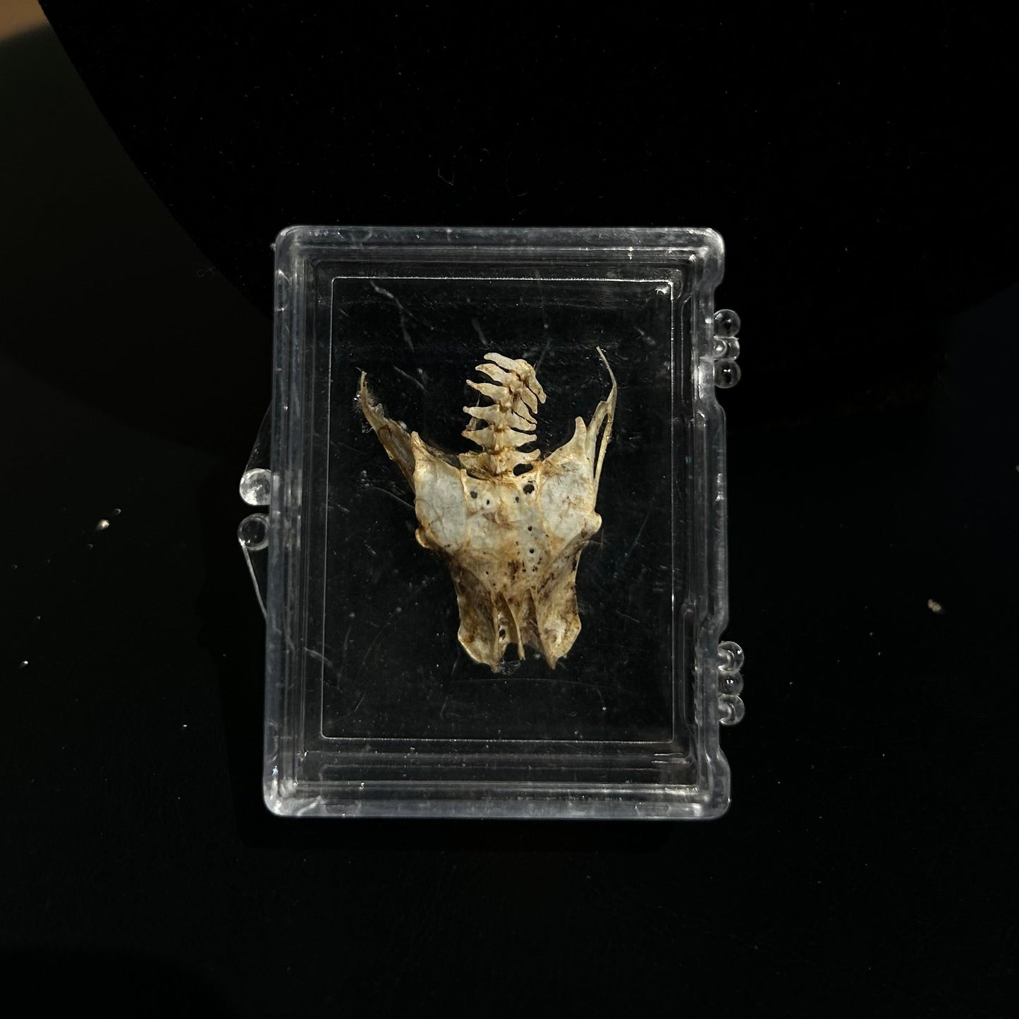 3D Pelvis