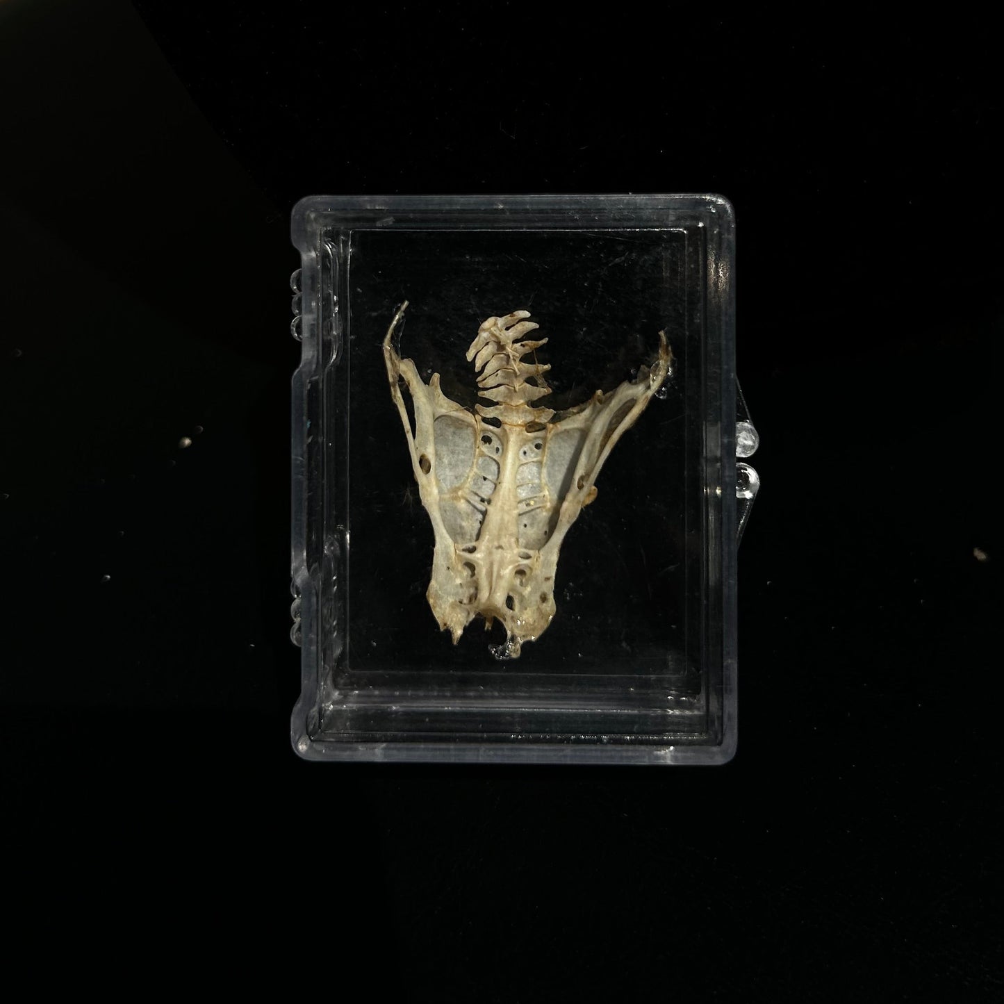 3D Pelvis