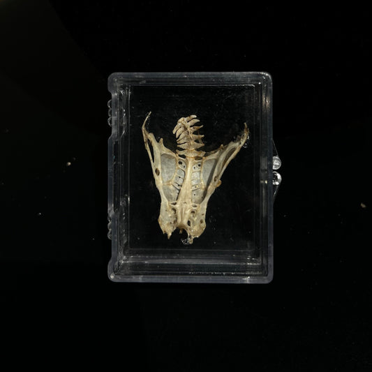 3D Pelvis